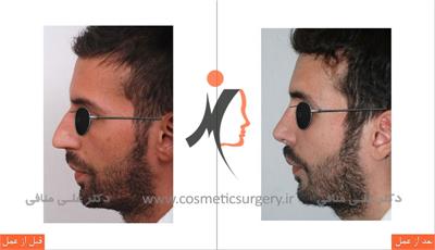 nouse cosmetic surgery 10