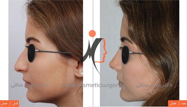 nouse cosmetic surgery