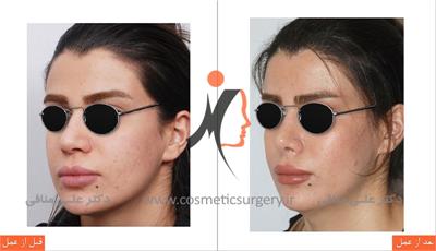 nouse cosmetic surgery 8