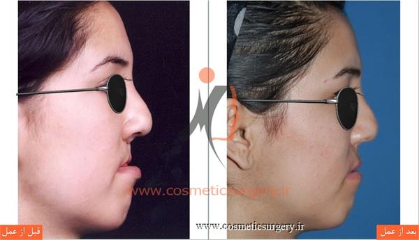 جراحی و ترمیم شکاف لب و کام